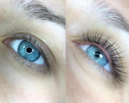 Szempilla Lifting – Természetes ív, nyitott tekintet